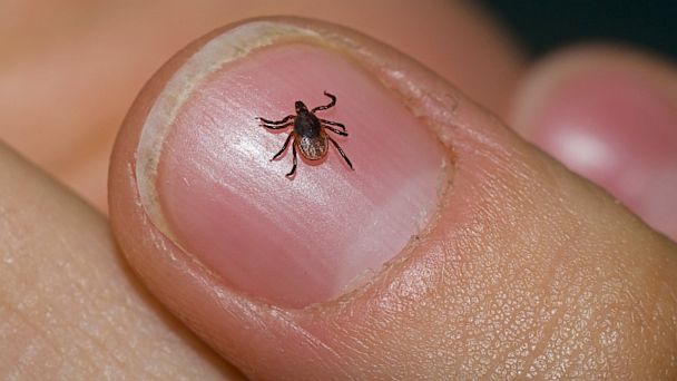 Integrative Medicine for Lyme Disease