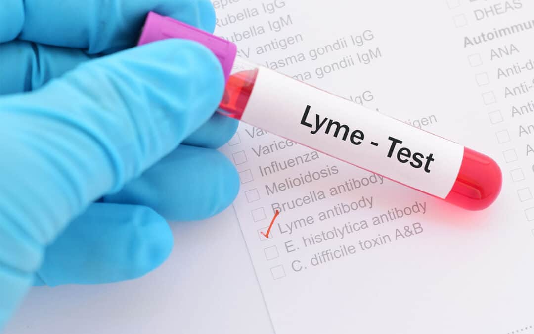 Lyme Disease and Mental Health Radio Interview